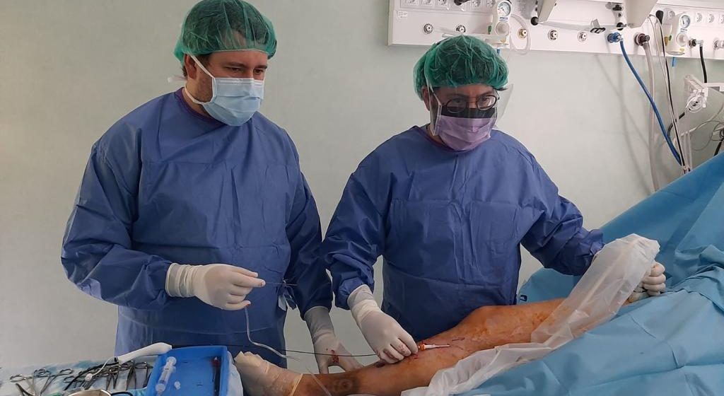 Hospital de Santarém com novo tratamento para as varizes